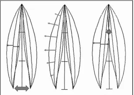 Figure 4.2 : Modèle mécanique simplifié (oscillation sinusoïdale limitée au plan horizontal) montrant l’effet combiné, sur le mode vibratoire des plis vocaux, d’une adduction dorsale insuffisante et d’une légère incurvation du bord libre des plis vocaux