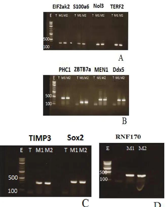 Figure  4  :  Electrophorèse  sur  gel  d’agarose  des  produits  de  PCR  sur  les  muqueuses  olfactives  de  deux rats adultes, pour tester l’expression des 11 gènes candidats