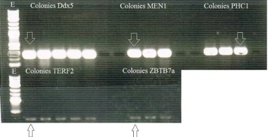 Figure 6 : PCR colonies pour pGEM-T-Ddx5, pGEM-T-MEN1, pGEM-T-PHC1 (haut du gel) et  pGEM-T-TERF2 et pGEM-T-ZBTB7a (bas du gel)