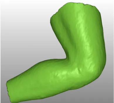 Figure 11 : exemple de genou modélisé. 