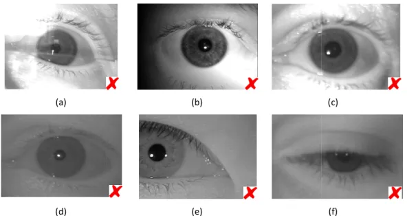 Figure 1-6: Examples of degraded iris images: (a) Specular reflection, (b) Irregular illumination, (c)  Out of focus, (d) Low contrast, (e) Off
