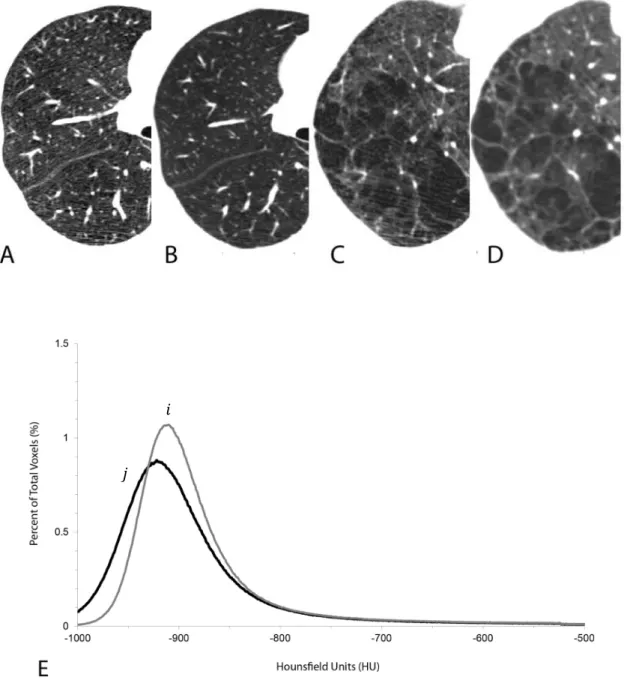 Figure 5. CT scans from two subjects scanned using a low dose CT scan (40 mAs) (A and C) and a clinical CT dose (120 mAs)  (B and D)