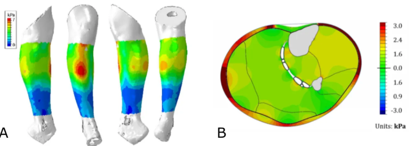 Figure 2.15: A - Illustration of pressure distribution applied by compression stockings over the leg [Dubuis 11]; B - Hydrostatic pressure in the leg soft tissues under elastic compression [Rohan 15]