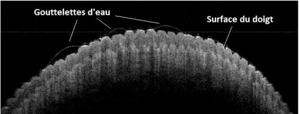 Figure 4.11 - B-scan OCT d'un doigt. Présence de gouttelettes d'eau sur la surface du doigt.