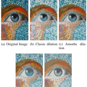 Fig. 2. Dilations of the image in (a) by means of square-shaped Structuring element with size 7 (b), morphological amoebas with radius 15 (c), AGNs with radius 60 (d) and CANs as ASEs with m = 15 (e)