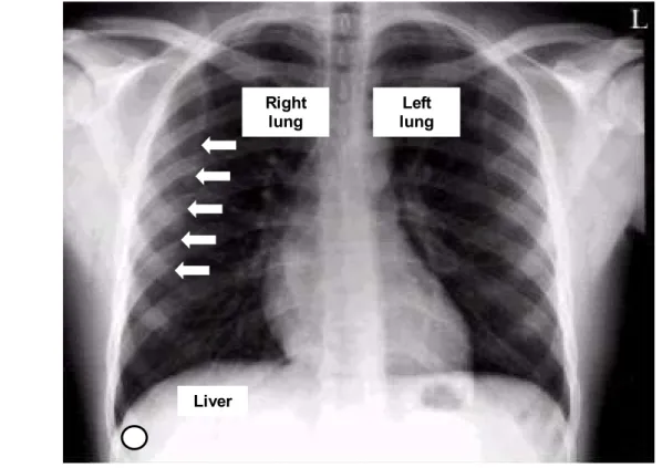 Figure 2 is an X-ray of a normal chest 3 . It shows the location of the organs that are relevant to  the case and provide a view of the material Dr Smith might have been working from