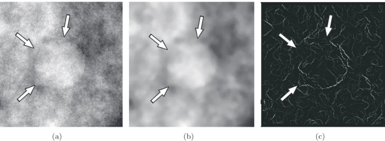 Figure 3.8: Problems in obtaining a closed contour from DBT data: (a) a raw simulated image, (b) a median filtered version of the same image and (c) the corresponding gradient image.