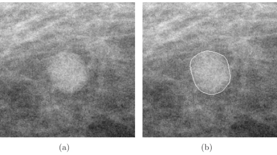 Figure 3.16: Manual segmentation by an expert: (a) ROI of a clinical image and (b) the reference contour extracted by an expert overlaid on the original image.