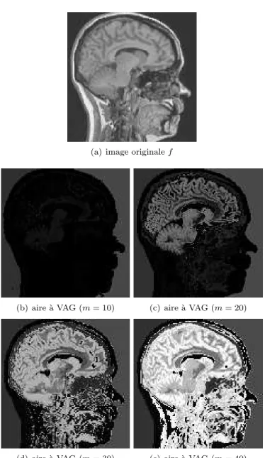 Fig. 6 – Caract´erisation multi-´echelle de l’aire ` a VAG de l’image originale f (a) suivant diff´erentes tol´erances d’homog´en´eit´e (b-e)