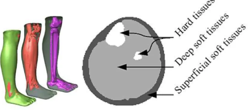 Fig. 1. Segmentation results: three-dimensional visualisation (left) and a cross section   with the 3 main regions (right) 