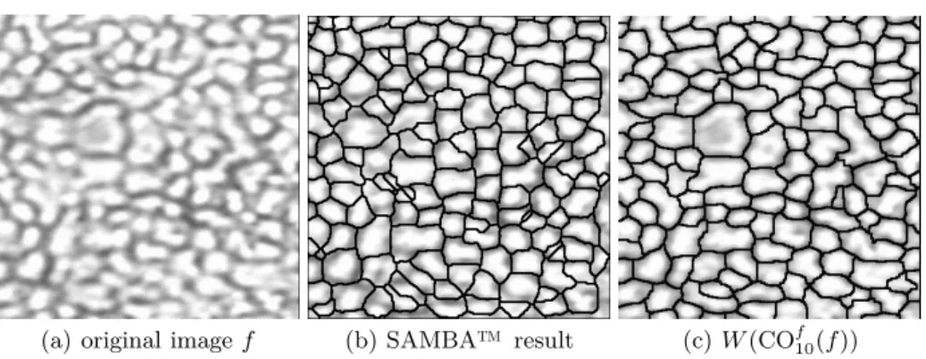 Fig. 5. Segmentation of human endothelial cornea cells (a). The process achieved by the GANIP-based morphological approach (c) provides better results (from the point of view of ophthalmologists) than the SAMBA™ software [22] (b).