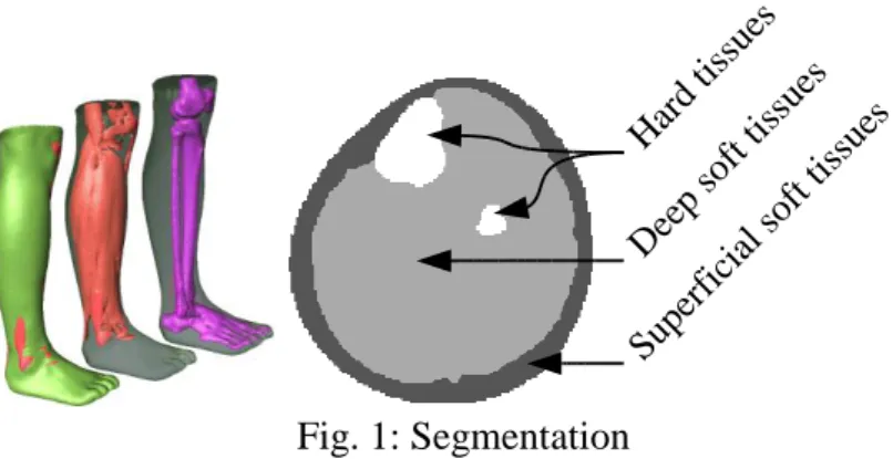 Fig. 1: Segmentation  Image warping 