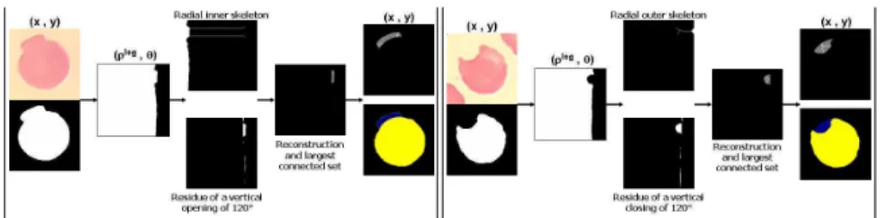 Fig. 3. Erythrocyte shape analysis: morphological algorithm for detecting extrusions (left) and intrusions (right).