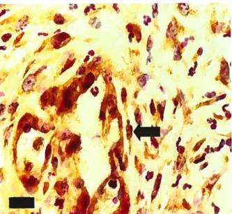 Fig 4. Immunohistochemical localization of TGF-13 RI in an equine limb wound at 14 days (60X; bar = 25 iim)