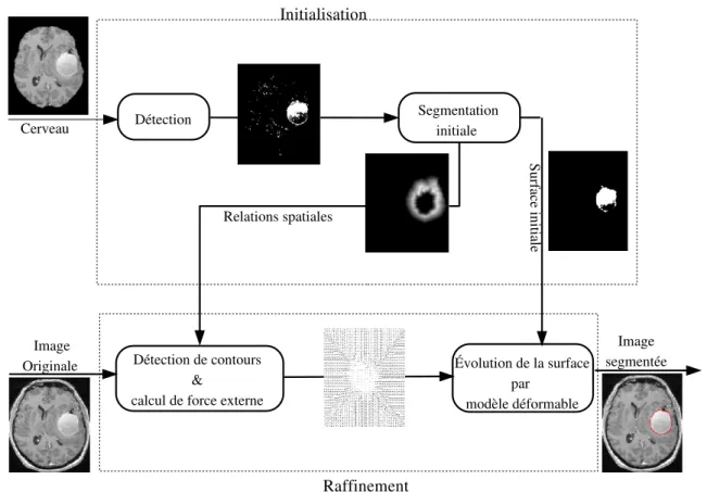 Figure 4: Sch´ema g´en´eral de la m´ethode propos´ee pour la segmentation automatique de tumeurs.