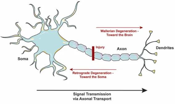 Figure 2.  Axonal degeneration. 
