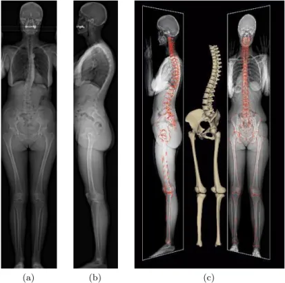 Figure 1 : Images EOS : (a) vue de face ; (b) vue de profil ; (c) reconstruction du squelette à partir d’acquisitions bi-planaires.