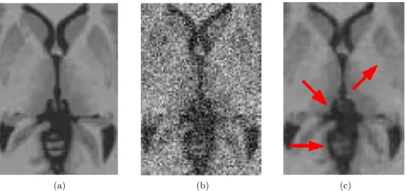 Figure 2.3: Application of NL-means filter to MRI brain images: (a) Input image;