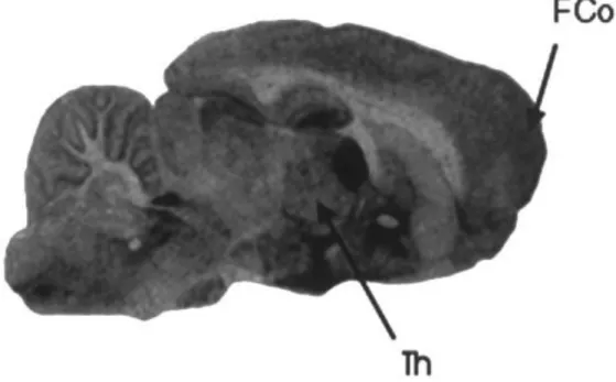 Fig. 1. Representative autoradiogram of [ 3 H]-nisoxetine binding sites to a sagittal section of normal rat brain