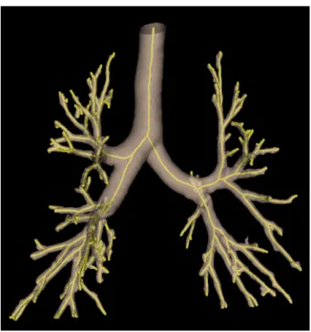 Fig. 4.19 : Axe central d’un arbre bronchique normal superpos´e au volume correspondant.