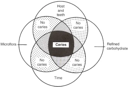 Figure 16 :   Diagramme illustrant la relation entre les facteurs  majeurs du processus de la carie dentaire 