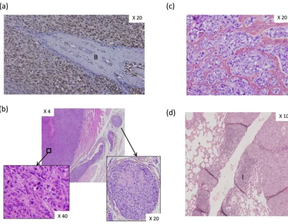 Figure 4. Histological analysis of experimentally induced osteosarcoma (OS) in athymic mice