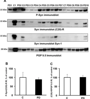 Fig.  1.  There are  no  differences  in  the  expression  levels  or  phosphorylation  state   of  alpha-synuclein  in  colonic  biopsies  between  control  subjects  and  patients  with  Parkinson’s disease