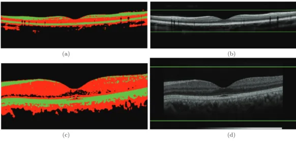 Figure 3.2 – Délimitation de la zone maculaire : (a) résultat de classiﬁcation par k- k-moyennes (K = 3), (b) déﬁnition des limites pour une image Spectralis