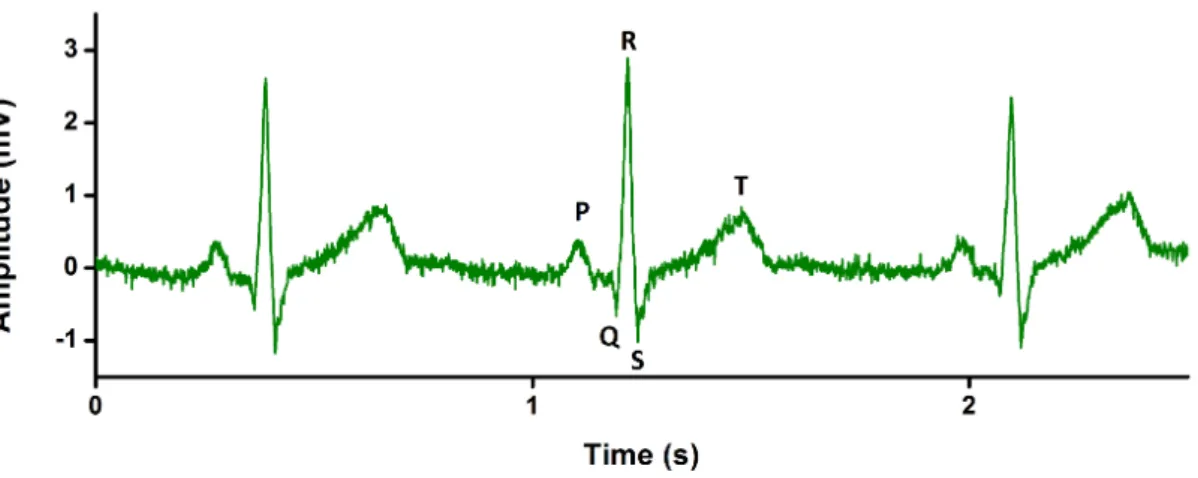 Figure 1.5 – Standard ECG signal. Example of an ECG signal with highlighted PQRST complex.
