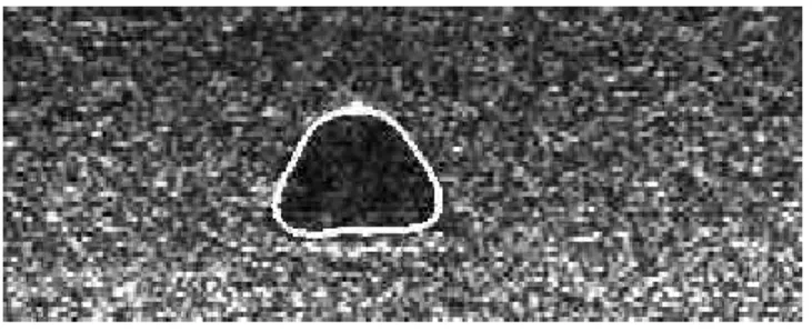 figure 13 : Résultat sur image réelle (ombre portée d’une mine Manta)