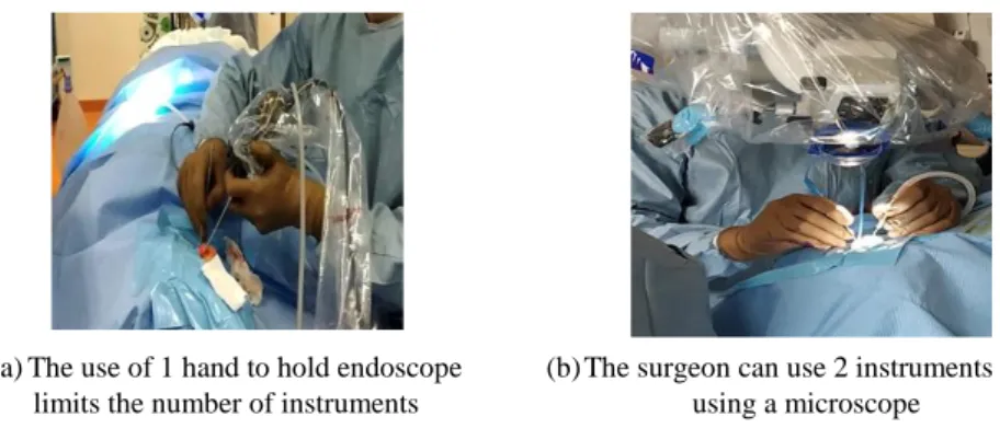 Figure 1 : The comparison of the number of instruments possible to use simultaneously while  using an endoscope and a microscope