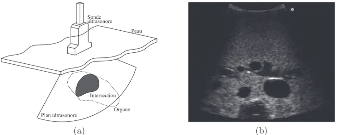 Figure 1.1 – (a) Plan ultrasonore généré et section d’organe analysé. (b) Image échogra- échogra-phique résultante.
