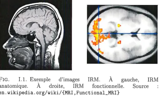 FIG. 1.1. Exemple d’images IRM. À gauche, IRM anatomique. A droite, IRM fonctiollnelle