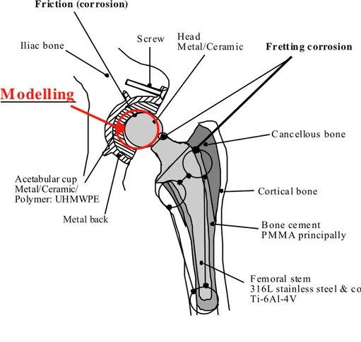 Figure 1: hip prosthesis  