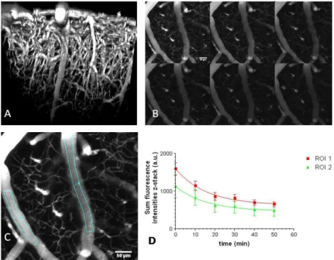 Figure 8 Functional cerebral vasculature in motor cortex of a 6 months old CD1 mouse at  different times after i.v