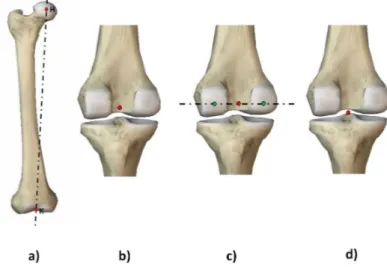 Figure 2.18 – Axe mécanique du fémur et les diﬀérentes déﬁnitions du centre genou