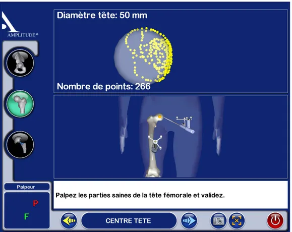 Figure 3.3 – Capture d’écran du logiciel de la solution Amplivision de la société Amplitude pour l’acquisition du centre hanche anatomique