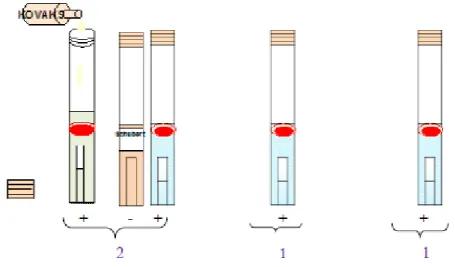 Figure 09 : Recherche et dénombrement des Coliformes Fécaux 