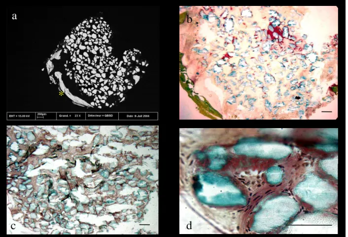 Figure 5: Histological  analysis of the biopsy harvested 3  years after  filling the dental socket  with  ICPCS  (case  1)