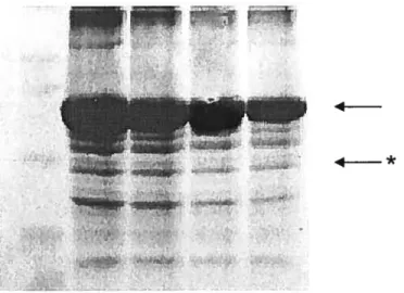 Figure 5. SDS PAGE results of extracted GAPDH and BSA by dichioromethane dissolution of the PLGA microspheres