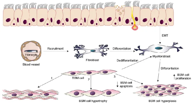 Figure 4.  Mécanismes du remodelage du muscle lisse bronchique dans l’asthme    EMT: epithelial mesenchymal transition; ECM: extracelluar matrix; BSM : Bronchial smooth  muscle (34) 