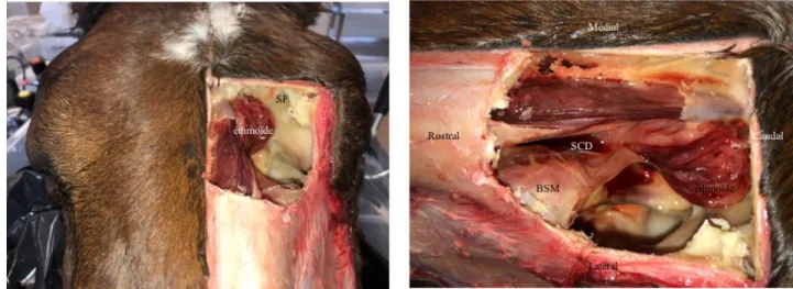 Figure 2. Vues dorsales du sinus concho-frontal. SF, sinus frontal; SCD, sinus conchal dorsal; BSM,  bulle  du septum maxillaire