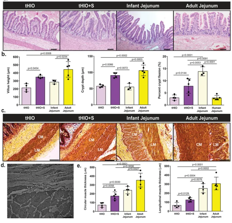 Figure 2. tHIO+S samples exhibit increased morphological characteristics