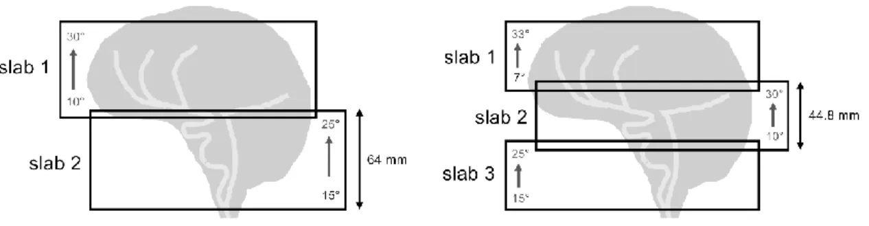Figure 3 : 2-slab and 3-slab TONE angulations. Linearly ascending flip angle profiles were addressed from the bottom to  the top of each slab