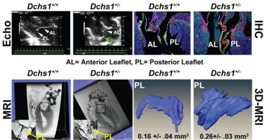 Figure 4. Dchs1 Deficiency Causes MVP and Myxomatous Degeneration in the Adult Mouse Echocardiography (Echo), MRI, Histopathology, and 3D reconstructions performed on  9-month old male Dchs1 +/+  and Dchs1 +/−  mouse hearts