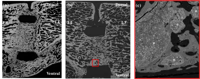 Figure 3. SEM images of failed bone fusions: (a) cage inserted between L 4  and L 5  vertebral  bodies and filled with autologous bone graft for which a clear discontinuity is present between  the two vertebral segments, 6 months after implantation,; (b) c