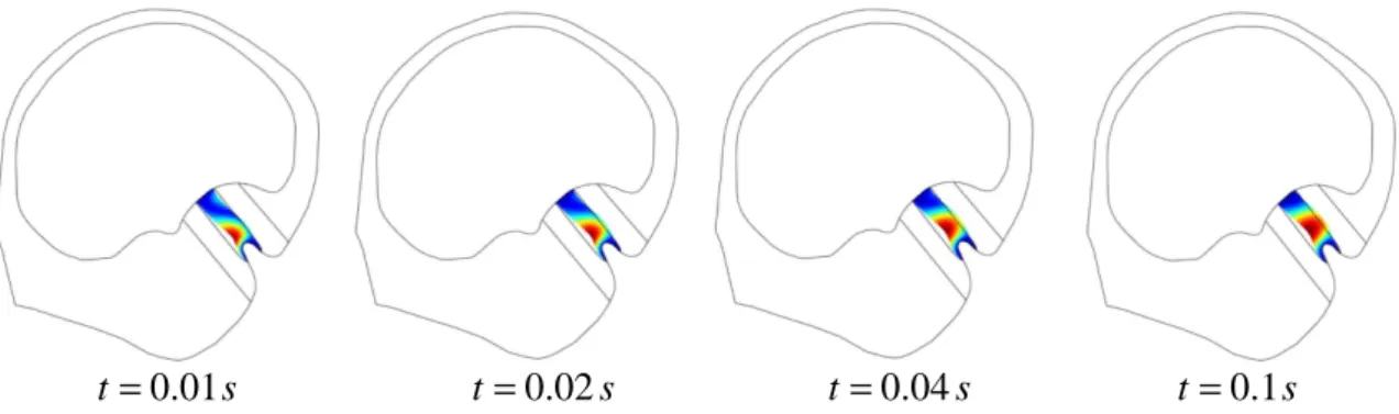 Figure  4.  Evolution  of  the  displacement  of  the  cupula  at  the  very  beginning  of  the  imposed  rotational  motion