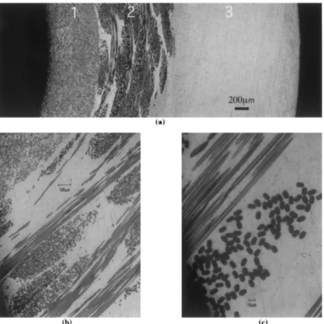 Fig. 12. (a) Optical micrographs of a hybrid MMC consisting in a core of Al–4wt.%Cu–1wt.%Mg–0.5wt.%Ag–SAFFIL (1), an interlayer of Al–4wt.%Cu–1wt.%Mg–0.5wt.%Ag–Nextel (2) and a surface layer of non-reinforced Al–4wt.%Cu–1wt.%Mg–0.5wt.%Ag (3)