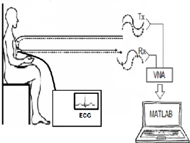 Fig. 2. S 21  phase of a non-breathing person (in degree).