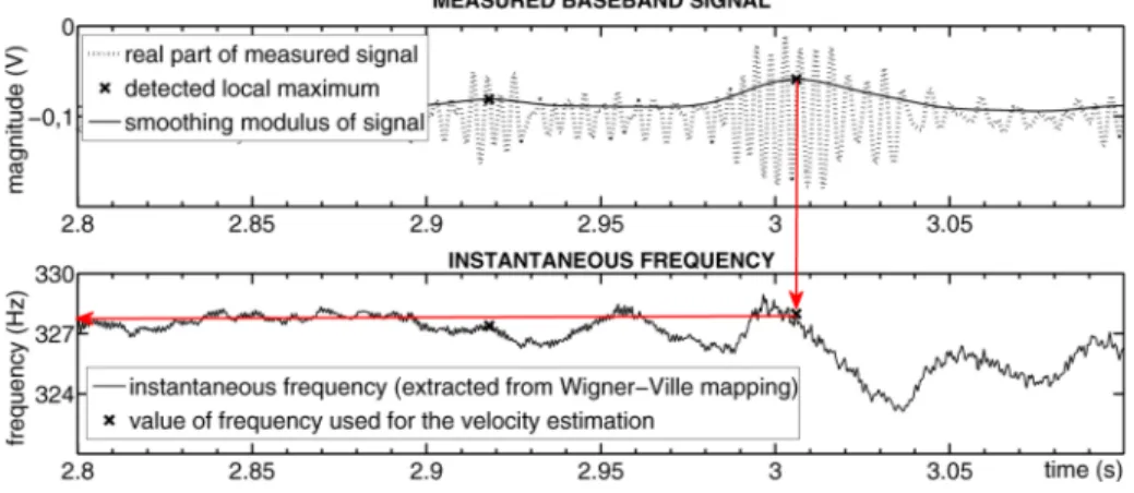 Fig. 6. (Up) Measured baseband signal s r b ( t ) and |ˆ s r b ( t )| and (down) the instantaneous frequency extracted from the PWVD mapping.